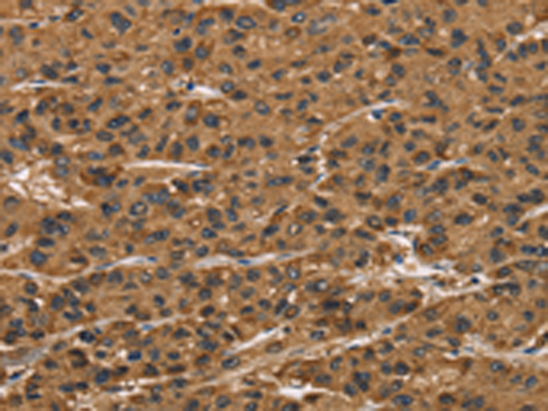 ATP7A 