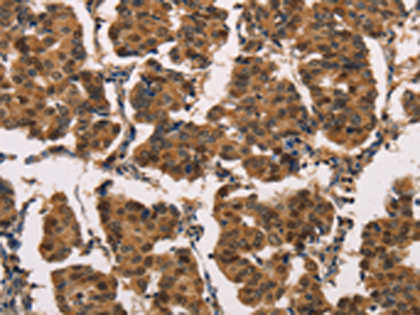 Rabbit Polyclonal Antibody to ATP7A 