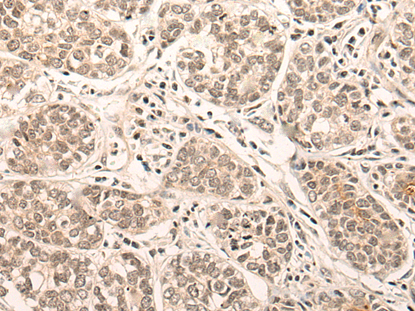 Rabbit Polyclonal Antibody to ATR