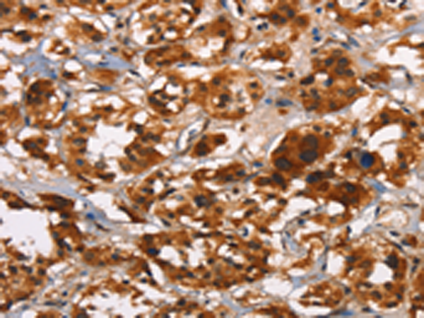 Rabbit Polyclonal Antibody to ATRN
