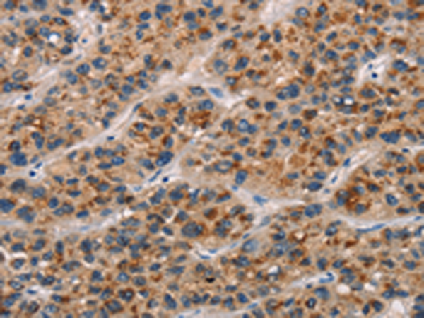 CD80