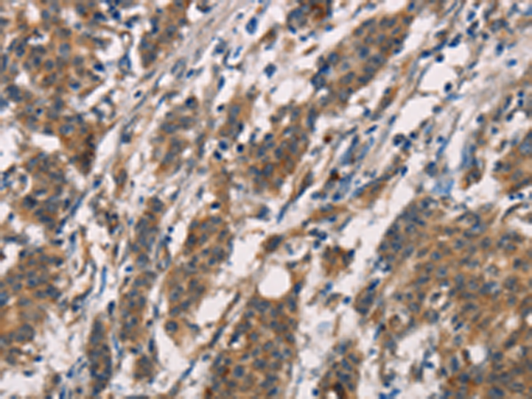 Rabbit Polyclonal Antibody to CD80