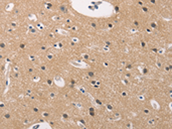 Rabbit Polyclonal Antibody to ADGRB1