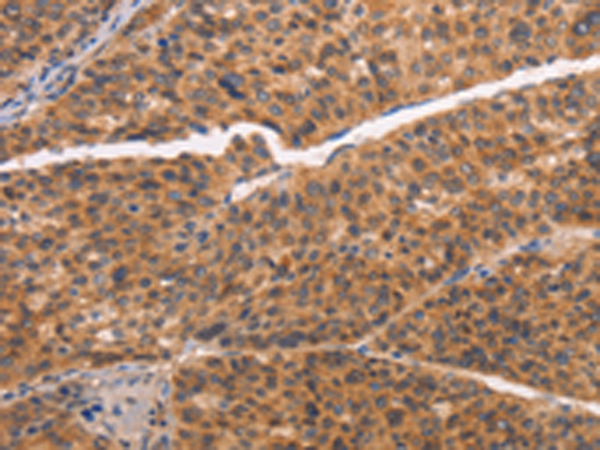 Rabbit Polyclonal Antibody to NCAPG2