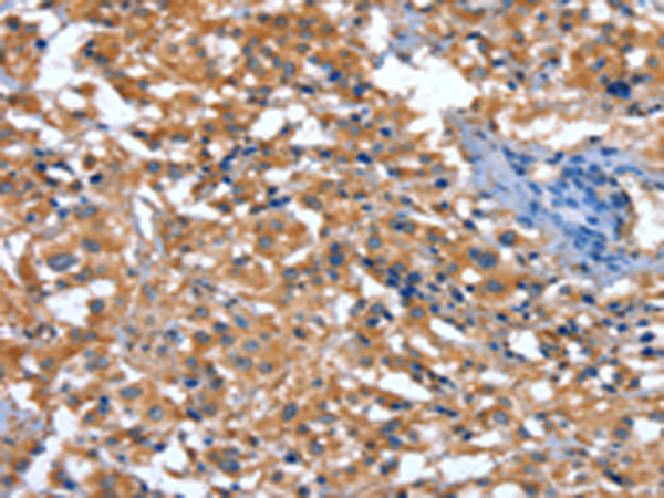 Rabbit Polyclonal Antibody to NOD2