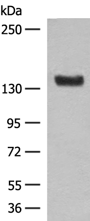 NCAM1