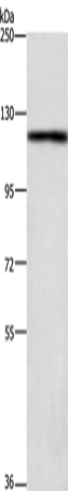 TSPYL2