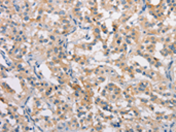 CLDN11