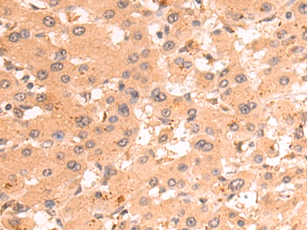 CTAG1A