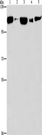 DNM2