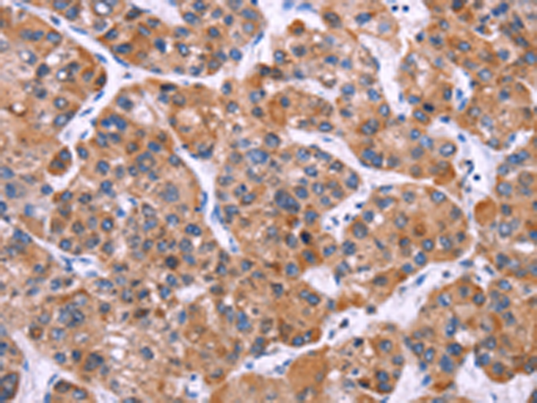 MSMO1