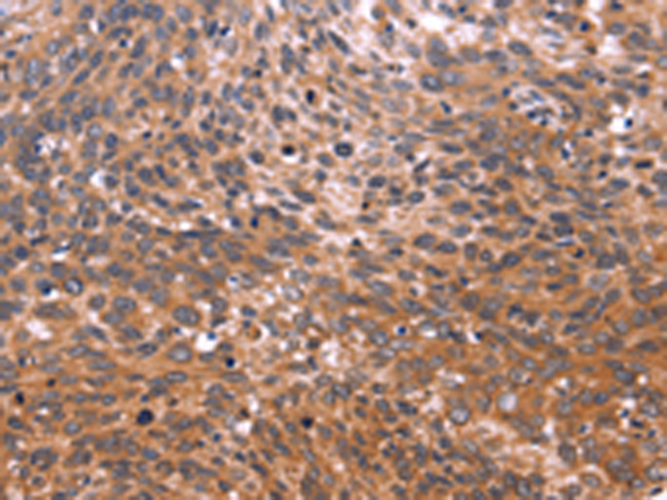 GCG(Glicentin)