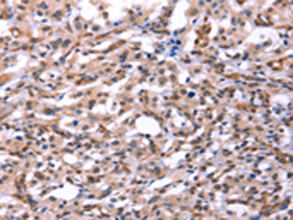 Rabbit Polyclonal Antibody to GCG(GLP2)