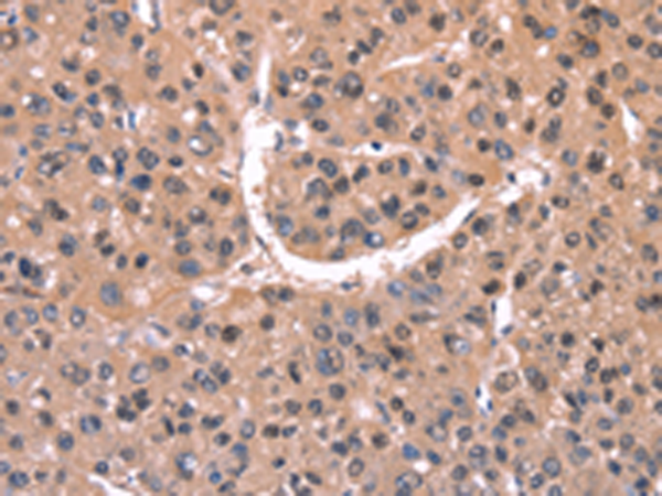 EXTL1