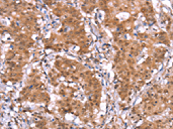 Rabbit Polyclonal Antibody to AMER1