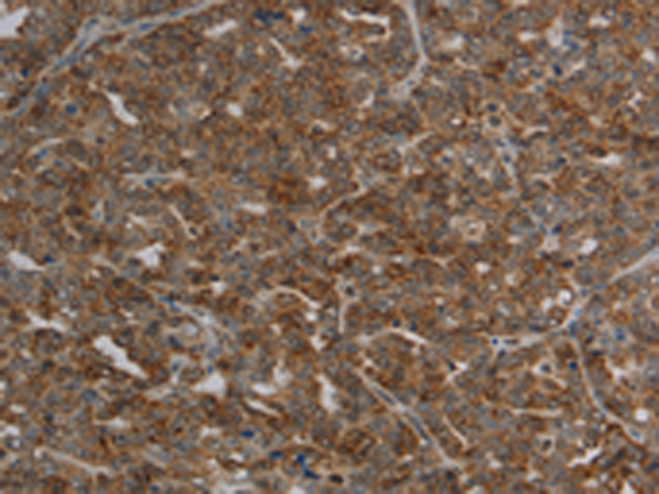 Rabbit Polyclonal Antibody to CFLAR