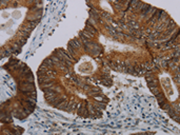Rabbit Polyclonal Antibody to CFLAR