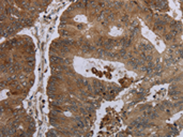 Rabbit Polyclonal Antibody to FOLH1B