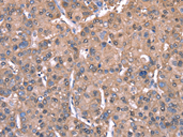 Rabbit Polyclonal Antibody to SPAST