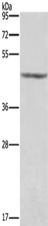 KCNJ9