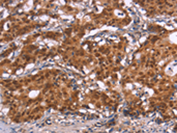 Rabbit Polyclonal Antibody to HIPK1