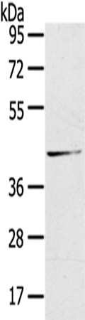 HSD11B2