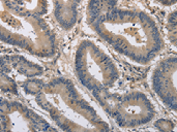 Rabbit Polyclonal Antibody to KCND1