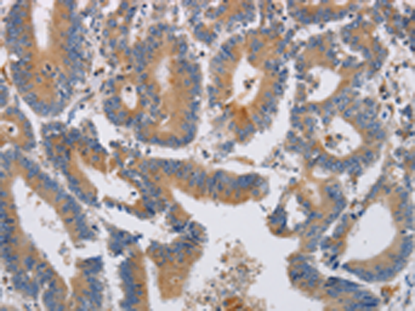 Rabbit Polyclonal Antibody to KCNG1