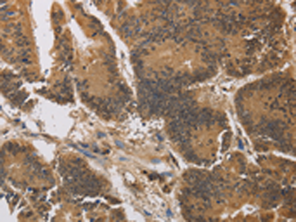Rabbit Polyclonal Antibody to KCNG4