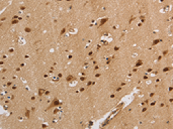 Rabbit Polyclonal Antibody to KCNG4
