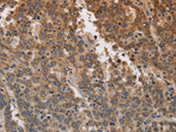 Rabbit Polyclonal Antibody to KCNK9