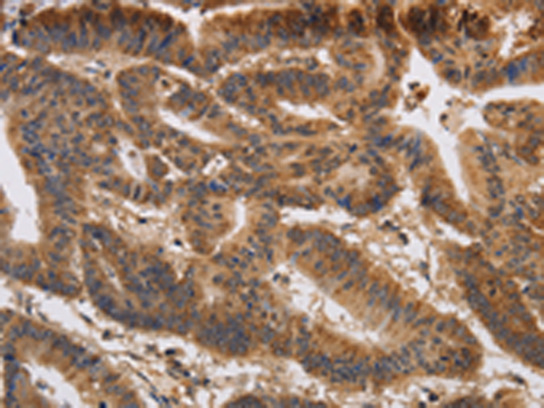 Rabbit Polyclonal Antibody to KCNK9