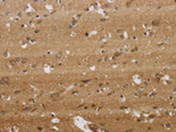 Rabbit Polyclonal Antibody to KCNMB2