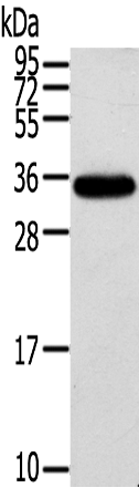 KCNMB3