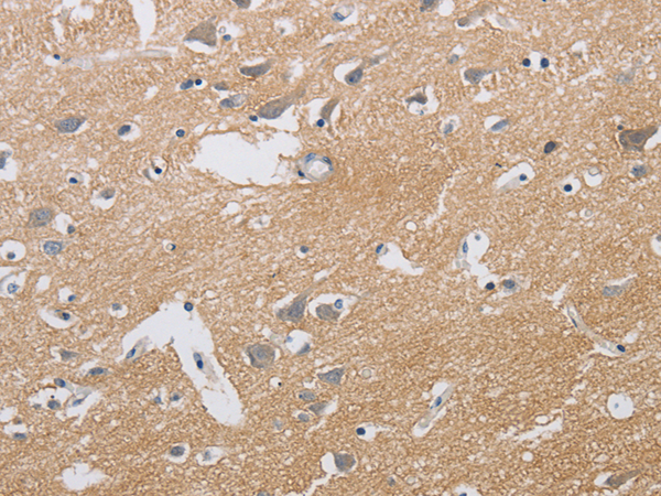 Rabbit Polyclonal Antibody to KCNMB3