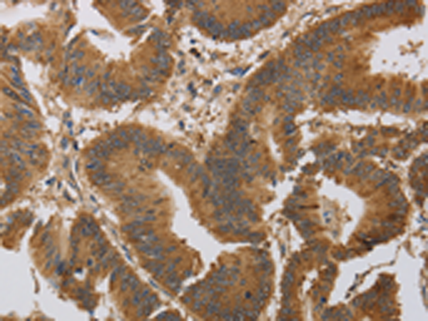 Rabbit Polyclonal Antibody to KCNMB4