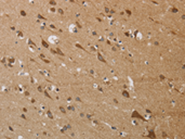 Rabbit Polyclonal Antibody to KCNMB4
