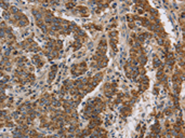 Rabbit Polyclonal Antibody to KCNQ4
