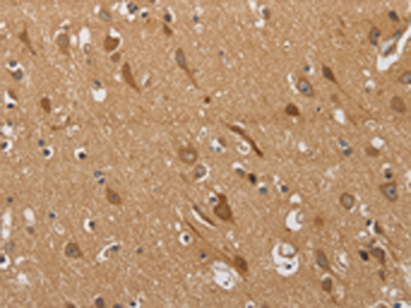 Rabbit Polyclonal Antibody to KCNQ4