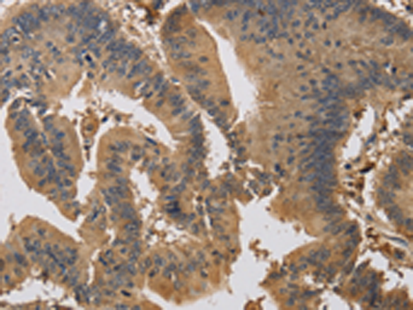 Rabbit Polyclonal Antibody to KIF22