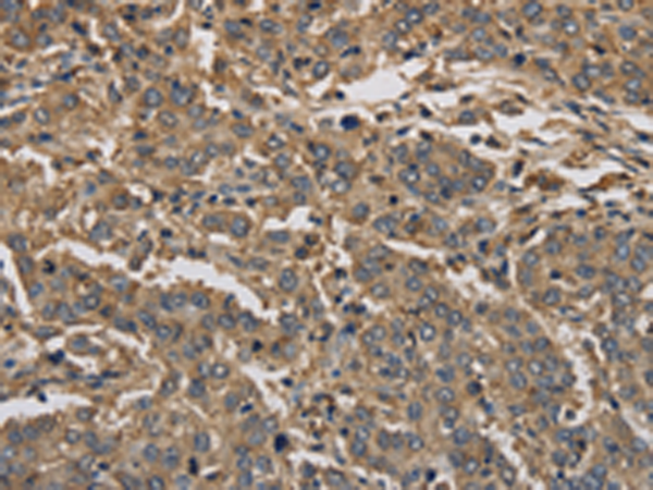 Rabbit Polyclonal Antibody to KIF22