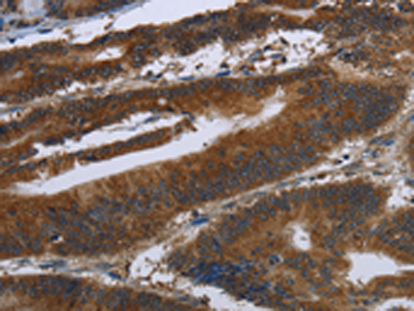 ARHGEF12