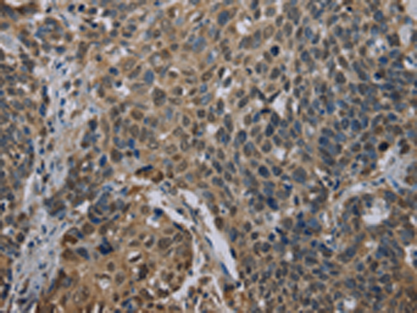 Rabbit Polyclonal Antibody to UBP1