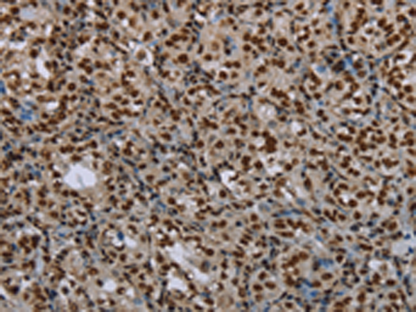 Rabbit Polyclonal Antibody to LEO1