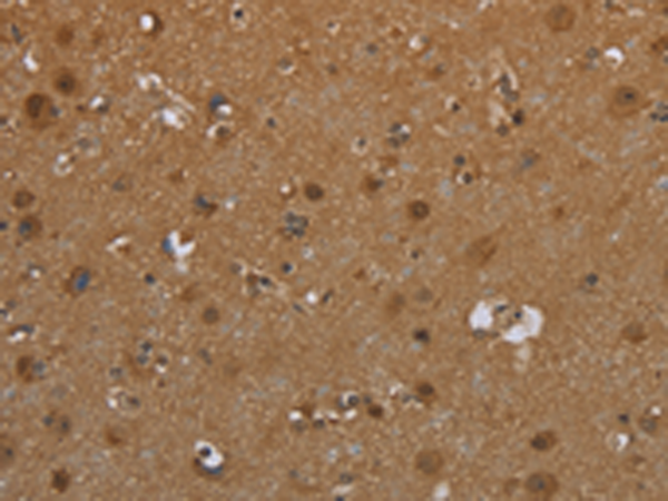 Rabbit Polyclonal Antibody to SCGB1D2