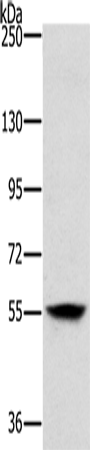 LOXL1