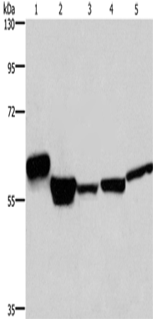 MFSD2A