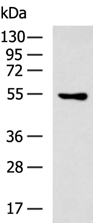 ERRFI1