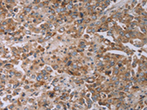 TNPO1