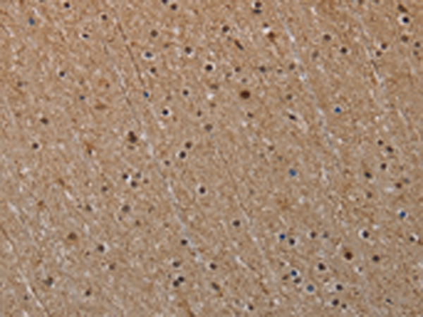 Rabbit Polyclonal Antibody to NLRP6